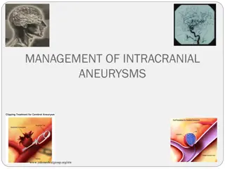 The Management of Intracranial Aneurysms