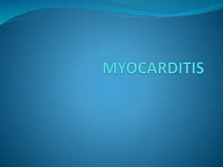 Myocarditis: Causes, Pathology, and Epidemiology