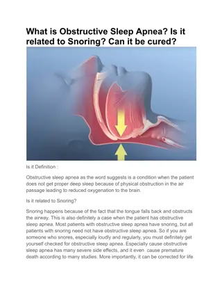 Top hospital for sleep apnea in Bangalore