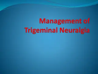 Trigeminal Neuralgia: History, Epidemiology, Clinical Features