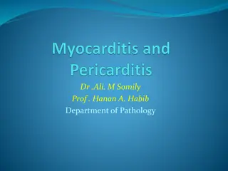 Myocarditis: Epidemiology, Risk Factors, and Management