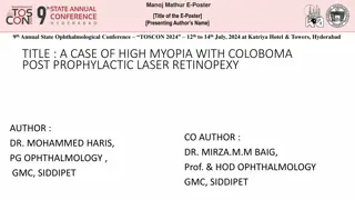 A Case of High Myopia with Coloboma Post Prophylactic Laser Retinopexy