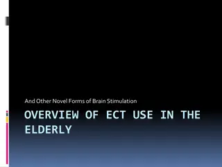 OVERVIEW OF ECT USE IN THE  ELDERLY