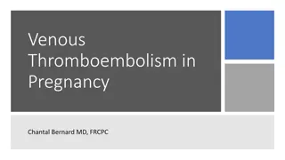 Venous Thromboembolism in Pregnancy: Risk Factors and Management