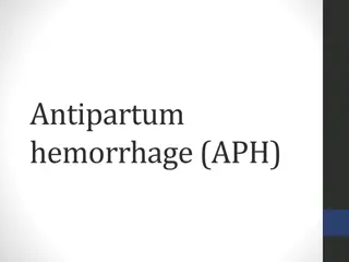Antepartum Hemorrhage: Causes, Management, and Investigations