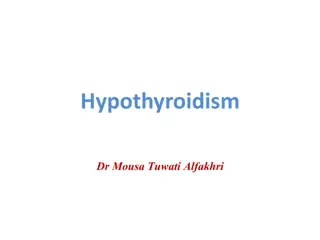 Hypothyroidism