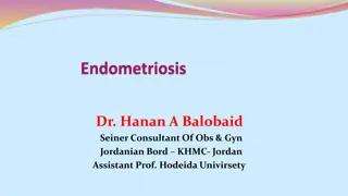 Symptoms and Management of Endometriosis