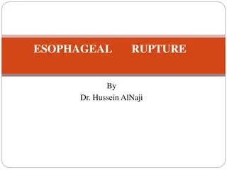 ESOPHAGEAL RUPTURE