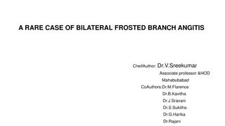 A RARE CASE OF BILATERAL FROSTED BRANCH ANGITIS