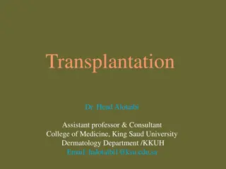Transplantation