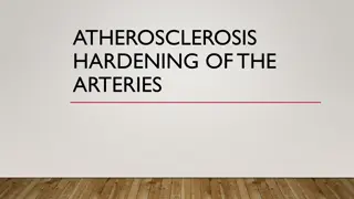 ATHEROSCLEROSIS