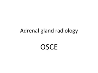 Adrenal Gland Radiology: Understanding Common Pathologies