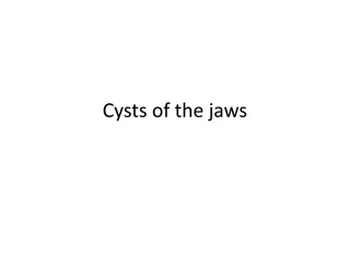 Cysts of the jaws