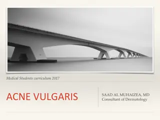ACNE VULGARIS