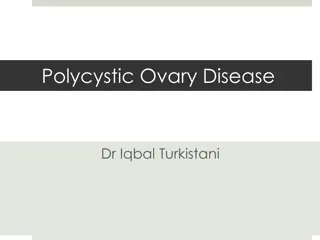 Polycystic Ovary Disease