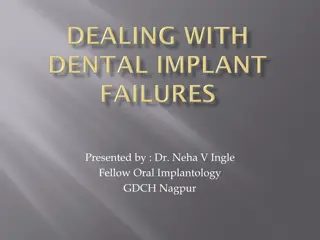 Methods for Dental Implant Failure