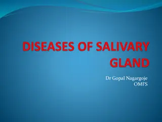 Salivary Gland Diseases and Disorders