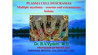 Multiple myeloma