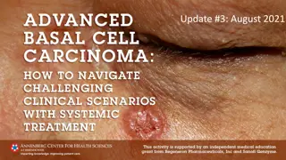 Evolving Management of Locally Advanced Basal Cell Carcinoma