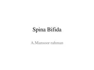 Spina Bifida - A Neural Tube Birth Defect