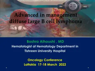 Advanced in management  diffuse large B cell lymphoma