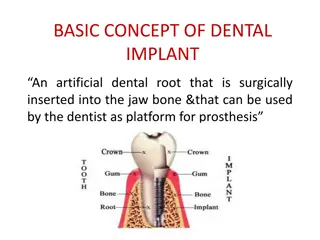 Comprehensive Overview of Dental Implants