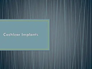 Cochlear Implants