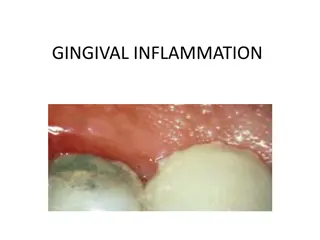 GINGIVAL INFLAMMATION