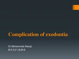 Complication of exodontia