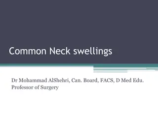 Common Neck swellings