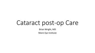 Cataract post-op Care