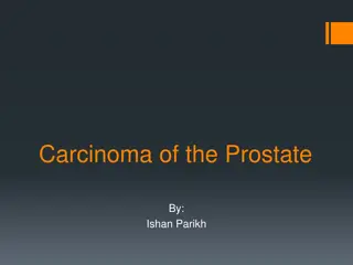 Prostate Carcinoma: Causes and Detection