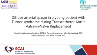 Diffuse Arterial Spasm in Turner Syndrome Patient during Valve-in-Valve Procedure