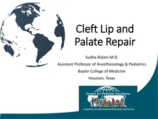 Cleft Lip and Palate Repair - Anesthetic Management Lecture