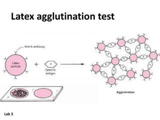 Latex agglutination test