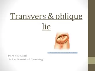 Transvers & Oblique Lie in Pregnancy