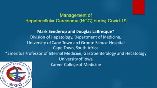 Management of Hepatocellular Carcinoma (HCC) During Covid-19