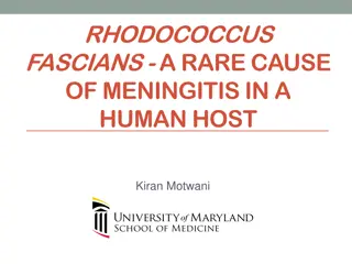 Overview of Tuberculosis Presentation and Diagnosis