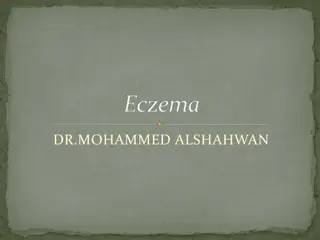 Eczema: Definition, Types, and Management