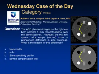 Slice Sensitivity Profiles in CT Scanning
