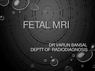 Fetal MR Imaging by Dr. Varun Bansal in Radiodiagnosis Department