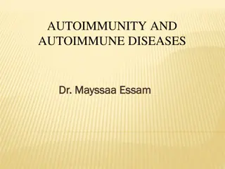 Autoimmune Diseases in SLE and Type I Diabetes