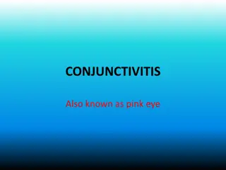 CONJUNCTIVITIS