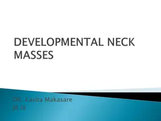 Thyroglossal Duct Cysts and Neck Masses