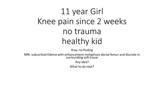 11-Year-Old Girl Knee Pain: MRI Findings & Next Steps