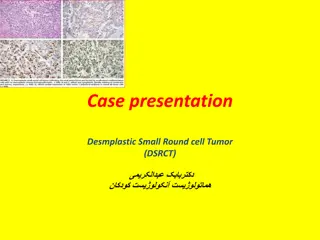Desmoplastic Small Round Cell Tumor (DSRCT) in a 5-Year-Old Boy: Case Presentation and Treatment Protocol