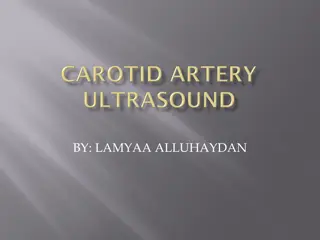 Carotid Arteries in the Neck