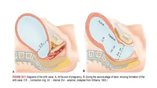 Abnormal Labor Patterns and Dystocia