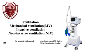 ventilation