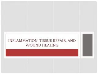 Inflammation and Tissue Repair